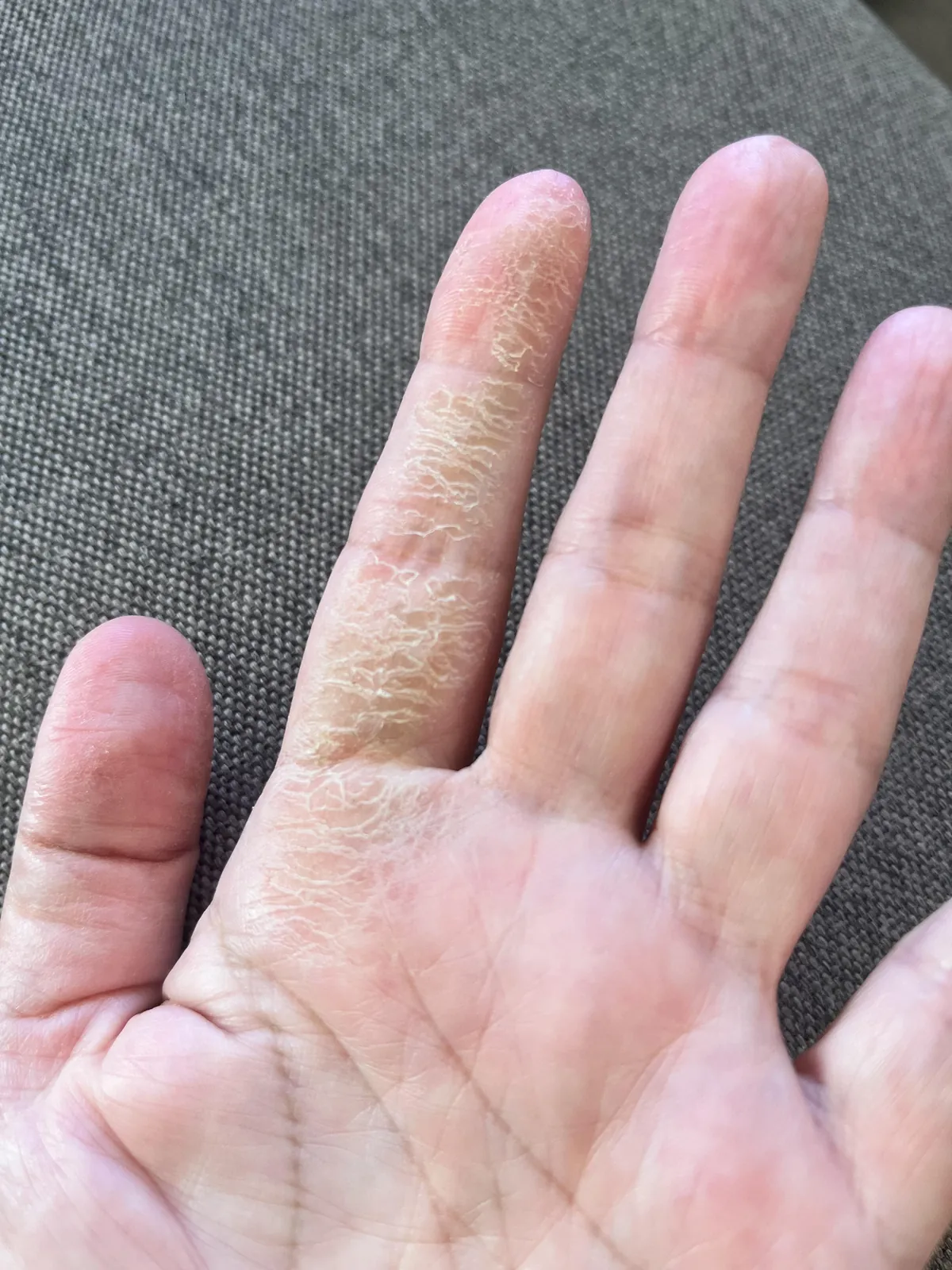 My finger after cutting and hollowing zucchini