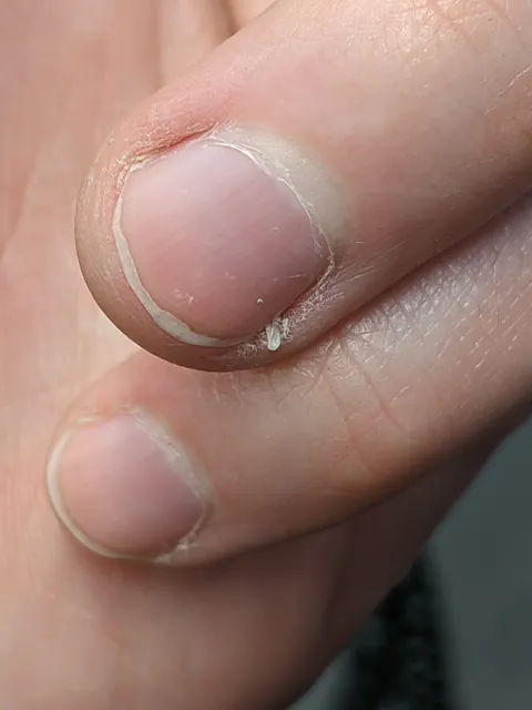 These nail barbs!!! WHY!!!