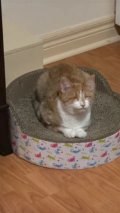 Born with no EyeBalls (anophthalmia)... My Beauty Queen