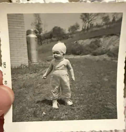 My uncle 18 months old poured a pot of hot coffee on his head. My grandparents were not the most responsible parents in the world