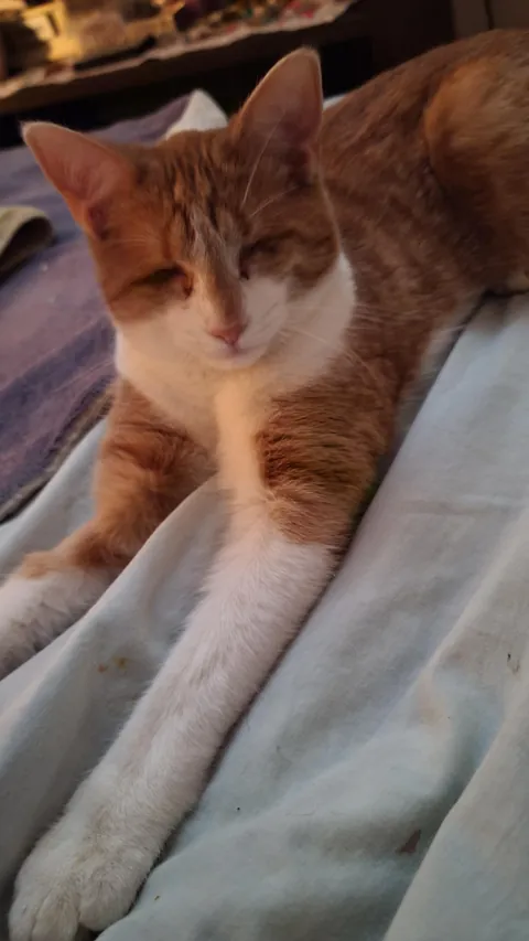 Born with no EyeBalls (anophthalmia)... My Beauty Queen