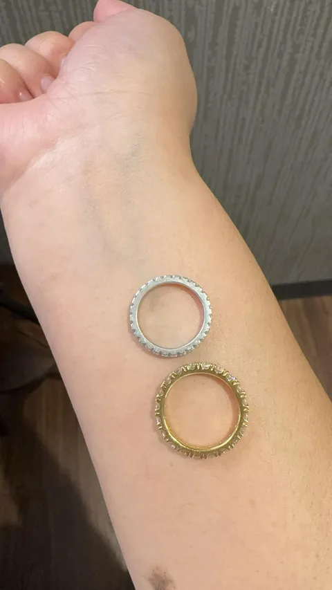 Please help. What’s my undertone?