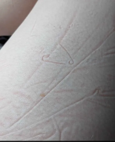 It appears that I slept on an open safety pin last night.