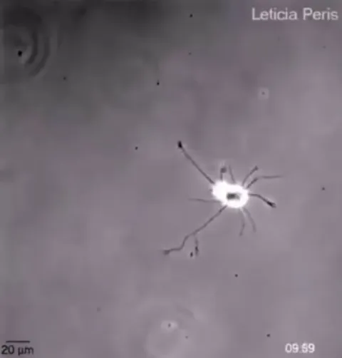 Single brain cell looking for connections