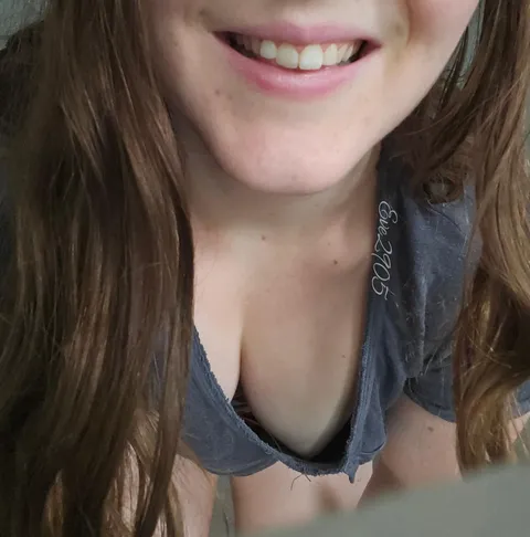 Caught you checking out my sunburn