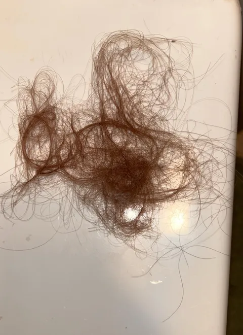 The amount of hair I’ve been losing after every shower recently