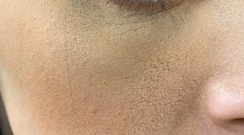 Why does my makeup looks like this at the end of the day?