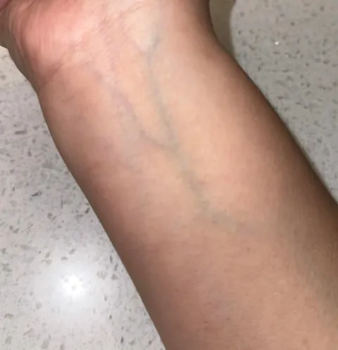 Please help. What’s my undertone?