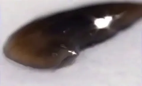 Flatworms can regrow whole bodies from a single slice using powerful stem cells called neoblasts, a striking example of nature’s ability to rebuild from almost nothing