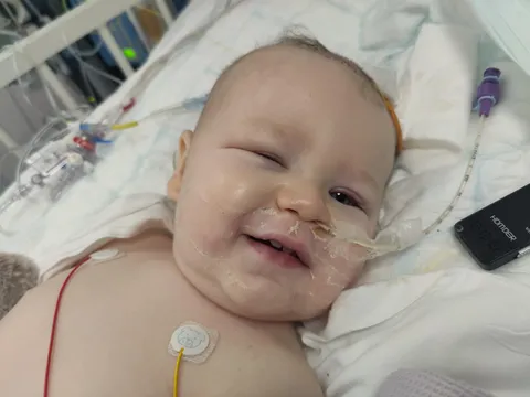 My 11 Month old Son just came off his ventilator this morning following a ruptured brain aneurysm 12 days ago. He's going to make it to his first birthday on Christmas Eve!!