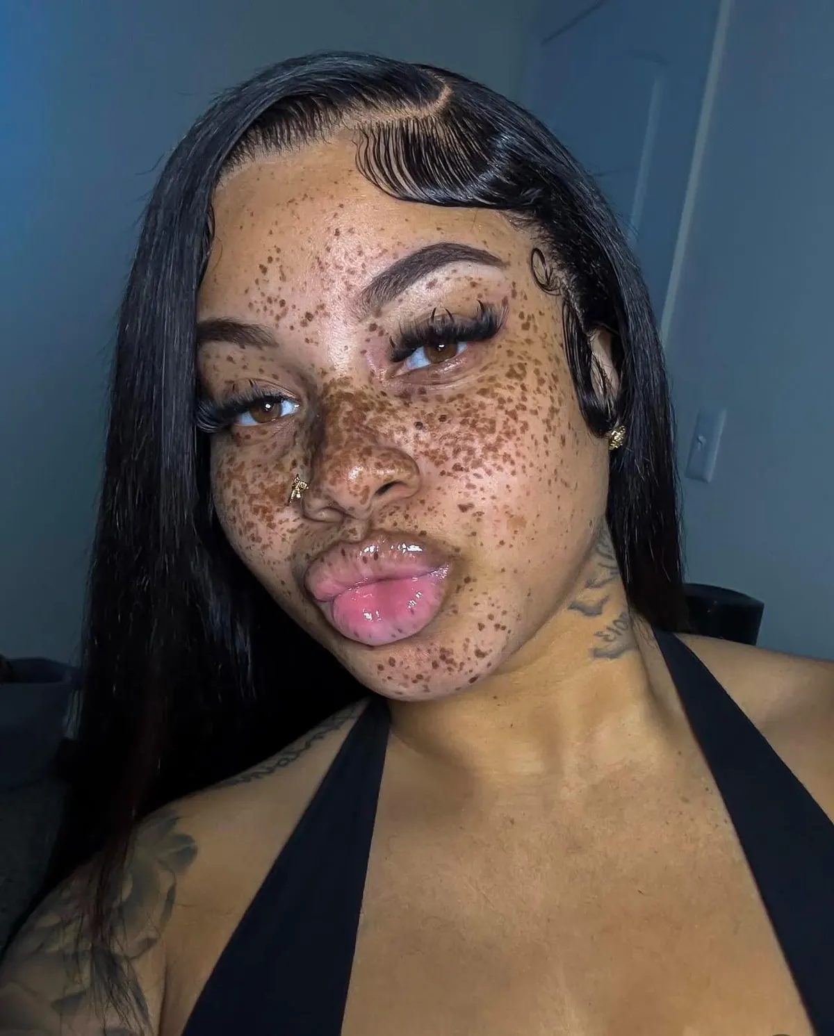 freckles😮‍💨🫶🏾