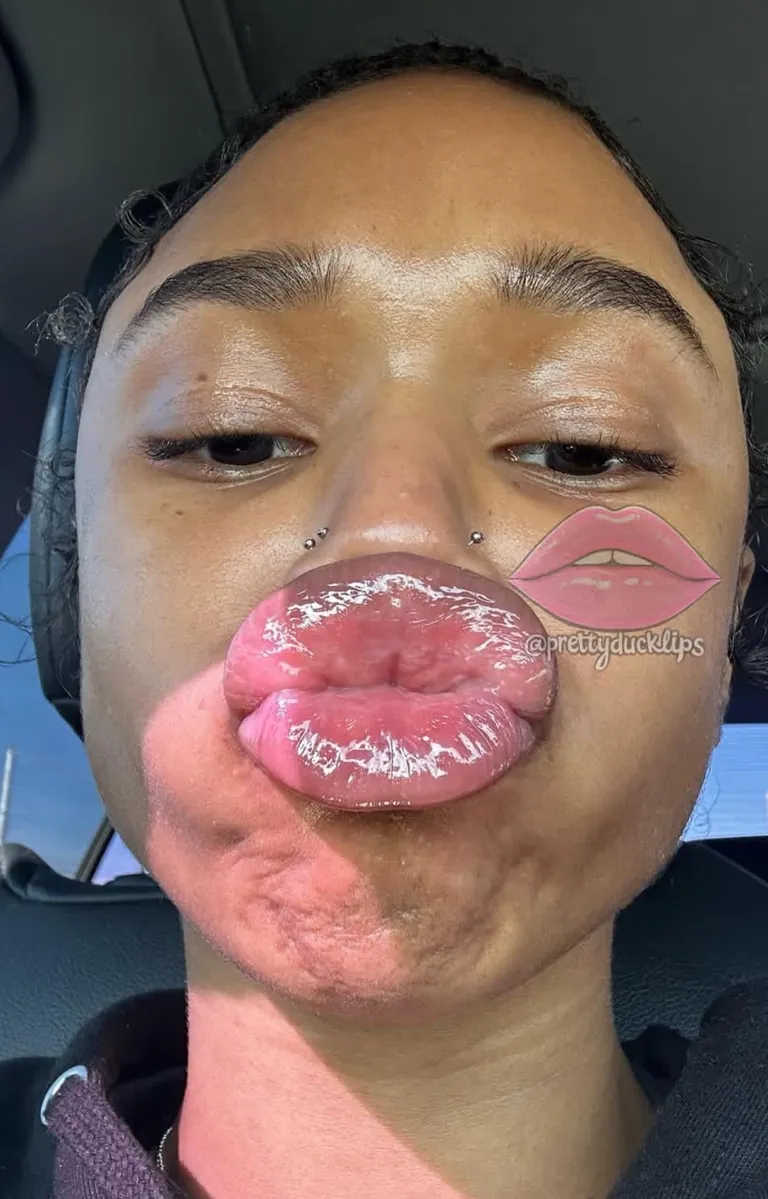 NEW NUTTY PACK (TOP 3?)