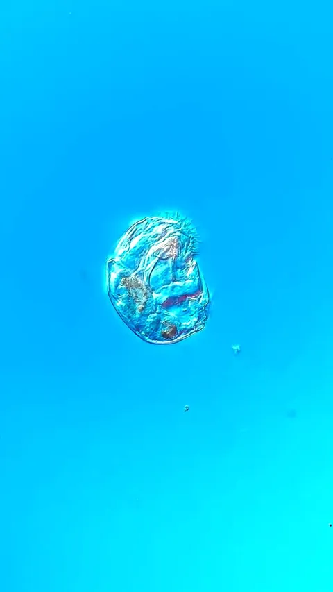 Rare Microscope Footage of Rotifer Pooping