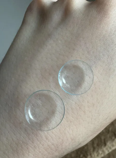 One of my contact lenses expanded overnight for no reason