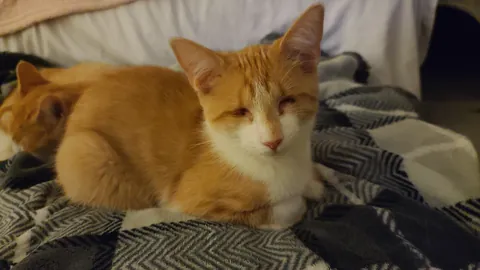 Born with no EyeBalls (anophthalmia)... My Beauty Queen