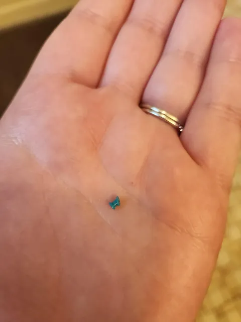 My kid's ear tube fell out