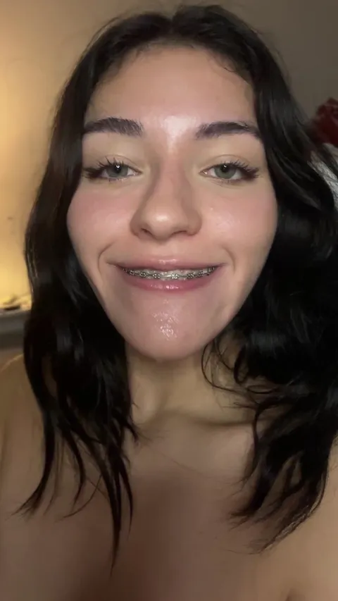 Are my braces silly or sexy?