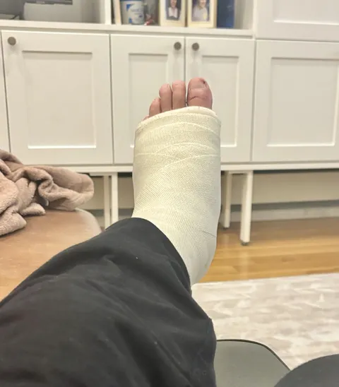 Cast was supposed to come off tomorrow