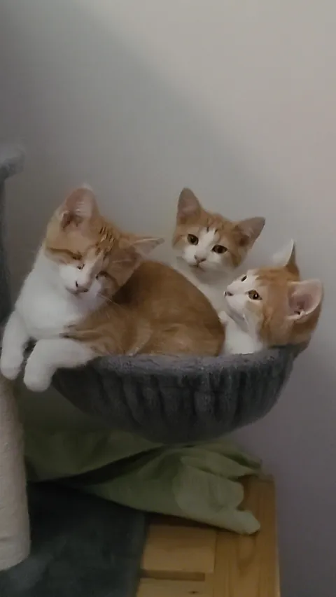 Born with no EyeBalls (anophthalmia)... My Beauty Queen