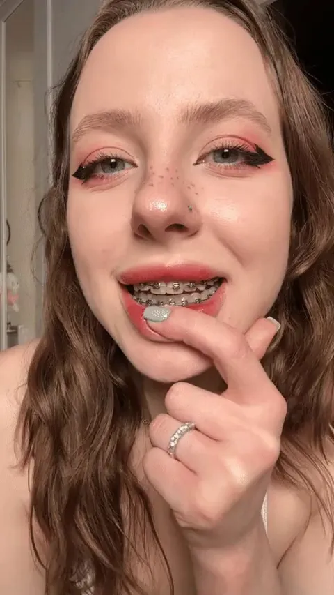 braces are so cute hehe