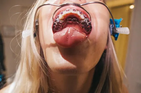 All this metal needs a good coating once in a while. Or maybe once a day. At least 🙈🤤