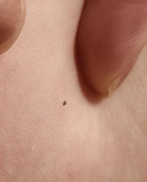 The tiniest tick I've ever found on myself.