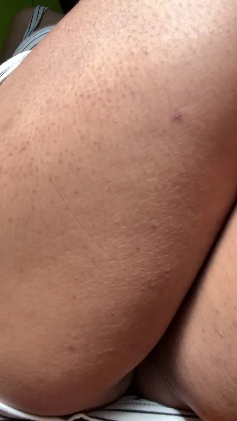 like this or more hairy?