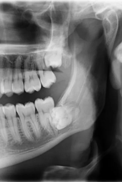 This explains the pain 