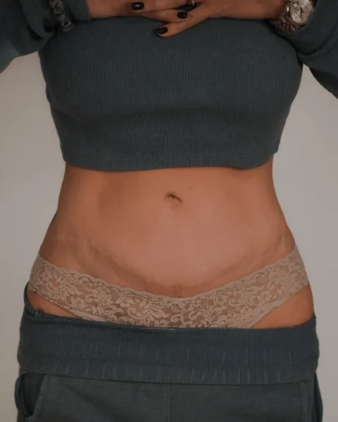 Scar tattoo cover ups (by me @karolinaszymanska_tattoo from Poland) 🌸