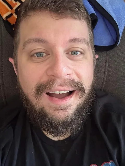 I’ve had dentures for one year!