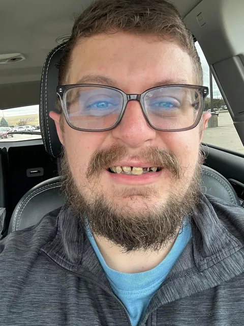 I’ve had dentures for one year!