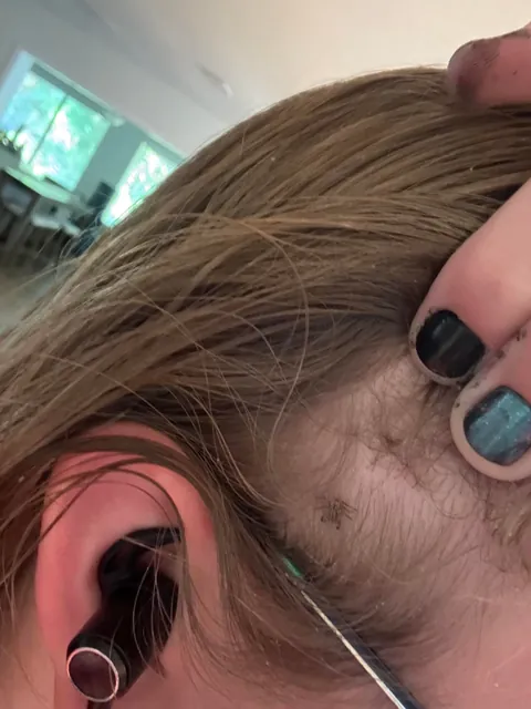 Was doing my nails and scratched my head… found a tick