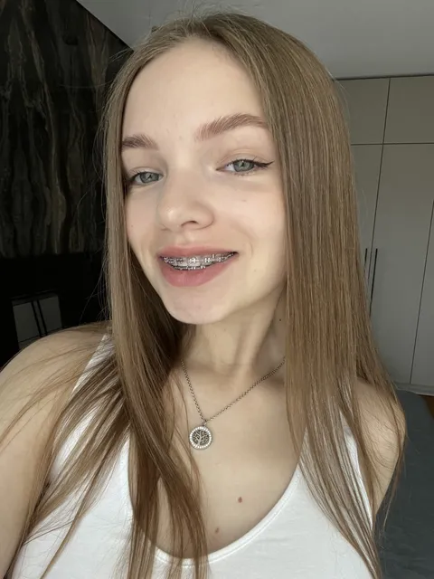 Do you like my braces