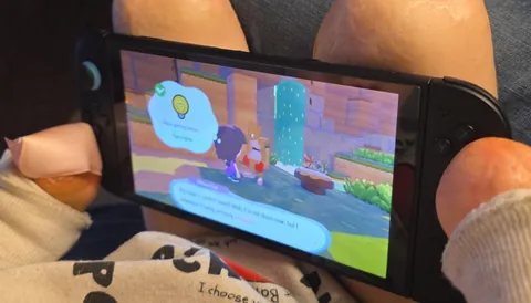 My little brother is a double amputee and he is absolutely loving running around and interacting with the world on the new Pokopia game