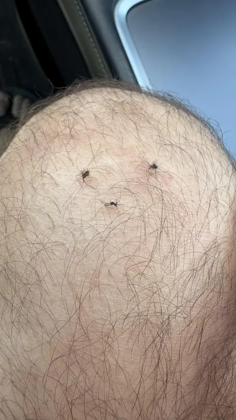 The hair on my right knee sometimes knots up
