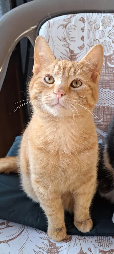 Before VS After vitiligo