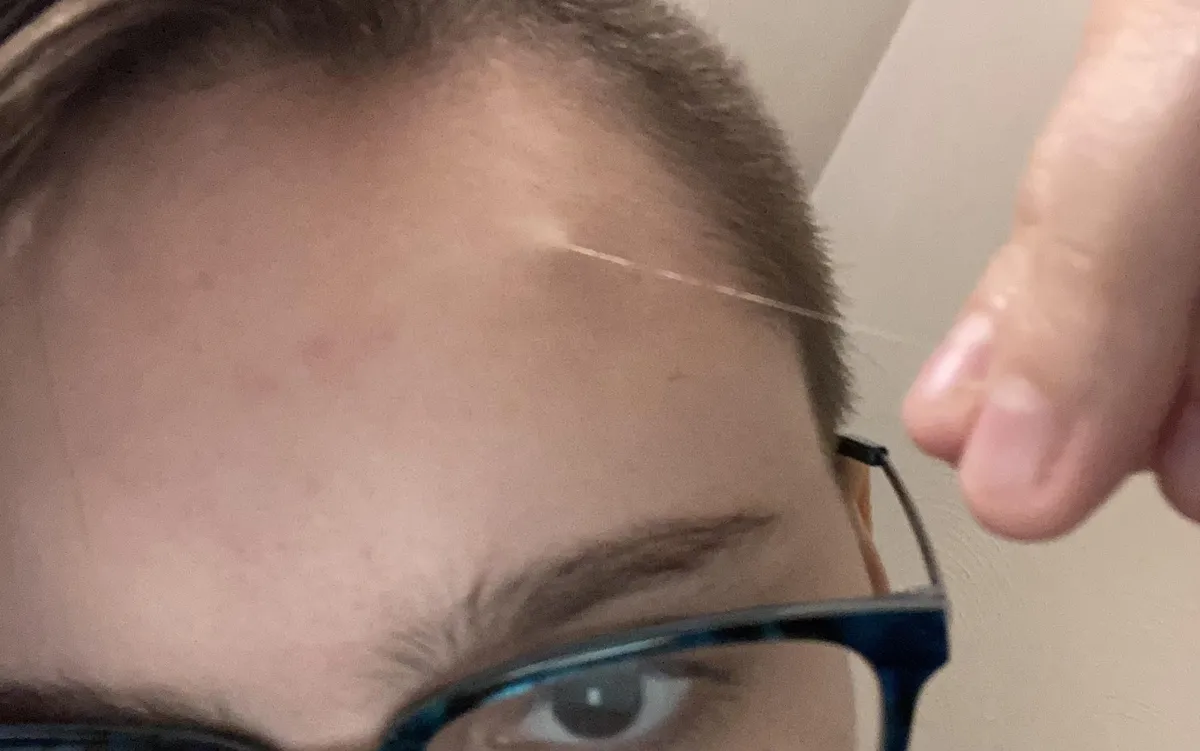 Had a long strand of hair growing out of my forehead