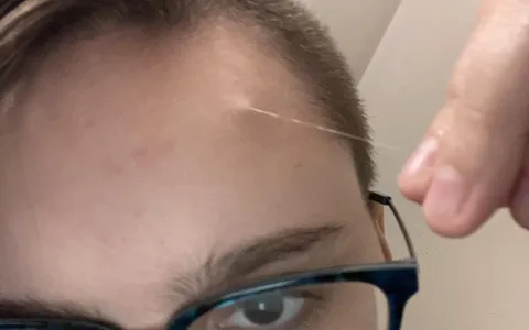 Had a long strand of hair growing out of my forehead