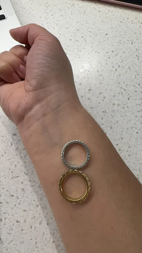 Please help. What’s my undertone?