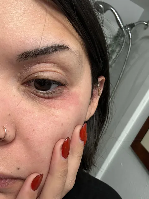 Watch my eyes blow up from the arnica in my concealer