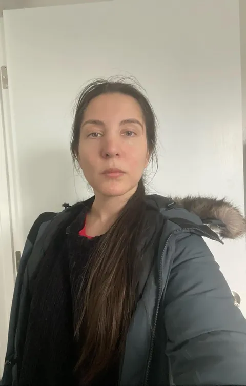 Got called ugly elf bitch on the night shift. Reminds me on when a man on the street called me snake eyed bitch. What else ya got? Almost 33F 💀