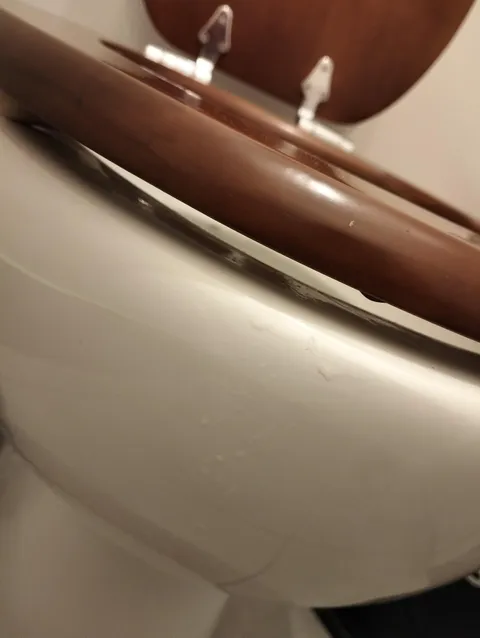 I pissed through this gap in the toilet seat accidentally, and now my pants are wet.