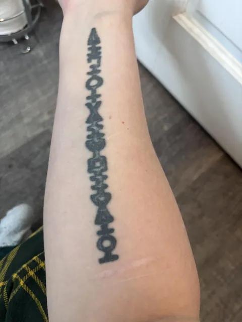 Guy who raped me did this tattoo…is it removable?