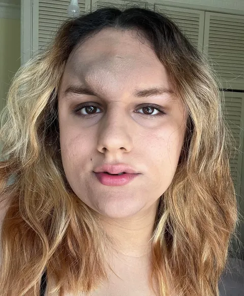 How do i get rid of the greyish tone around my mouth and forehead?