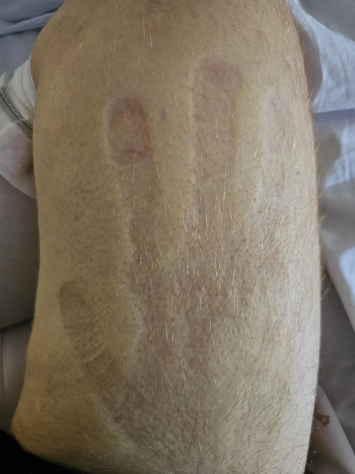 Handprint on my leg