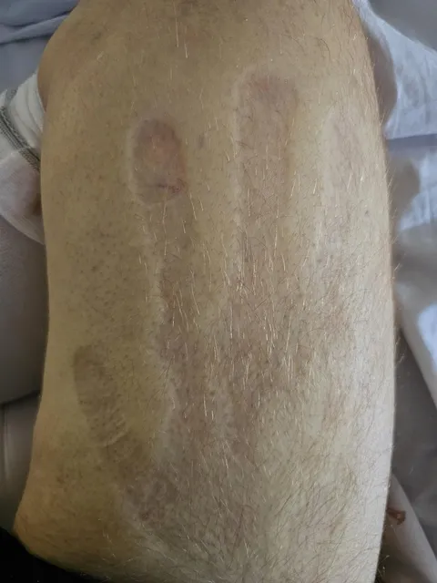 Handprint on my leg
