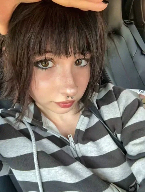 My freckles are coming out [F]