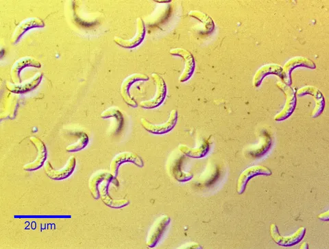 This Unicellular lives in your Brain, infected between 30-50% of human Population, Controls You and makes you love cats