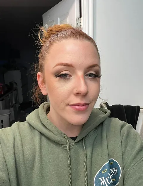 Massive Black Eye Cover Up Before &amp; After