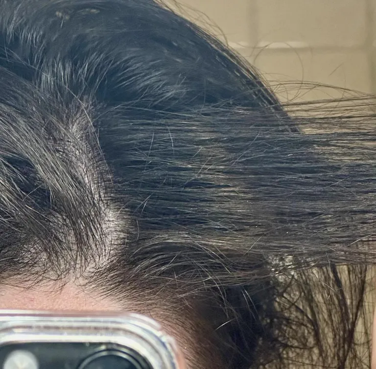 hair that grew while i was sick grew in blonde, then went back to black once i recovered